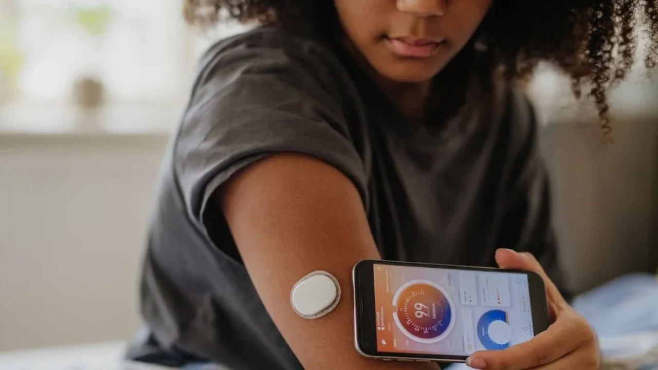 W29 - El modelo de negocio detrás de DexCom
